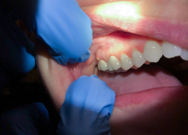 Best Emergency Gum Pain Relief  in South Euclid, OH